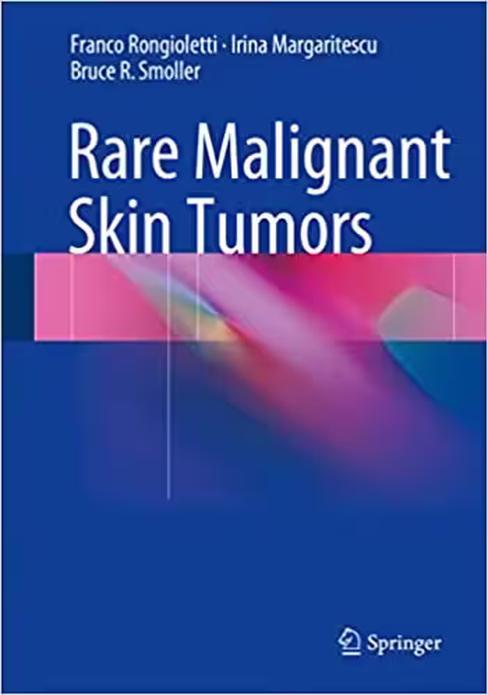 󾕇 دانلود کتاب Rare Malignant Skin Tumors, 2015 - دانلود کتاب های دانشگاهی