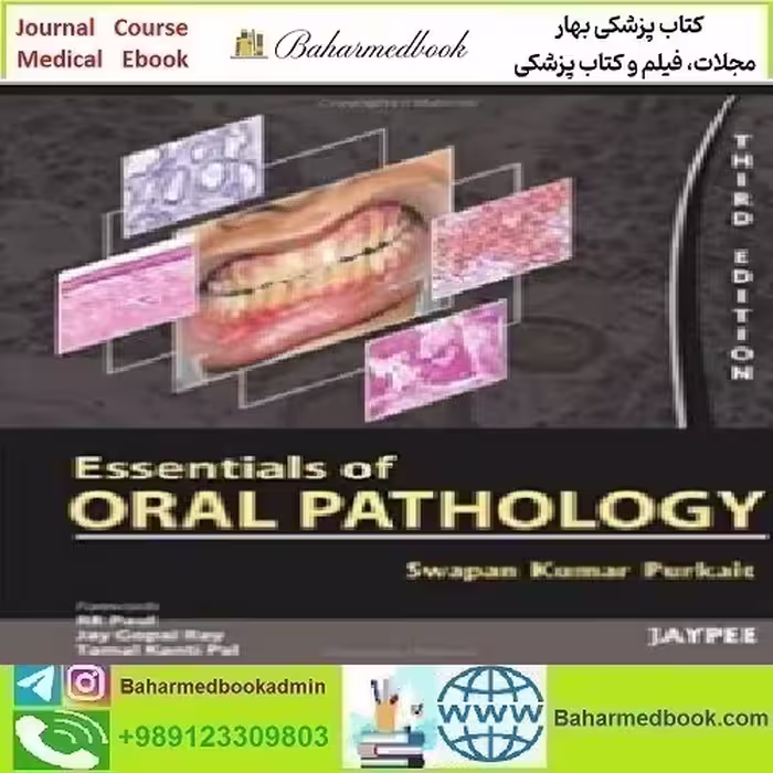 Essentials of Oral Pathology 2011 TRUE PDF price 1€ - کتاب پزشکی بهار