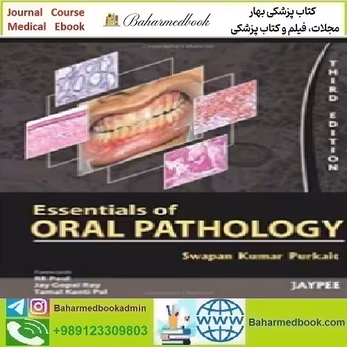 Essentials of Oral Pathology 2011 TRUE PDF price 1€ - کتاب پزشکی بهار