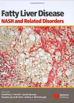 [PDF] دانلود کتاب Fatty Liver Disease - Nash And Related Disorders, 2005