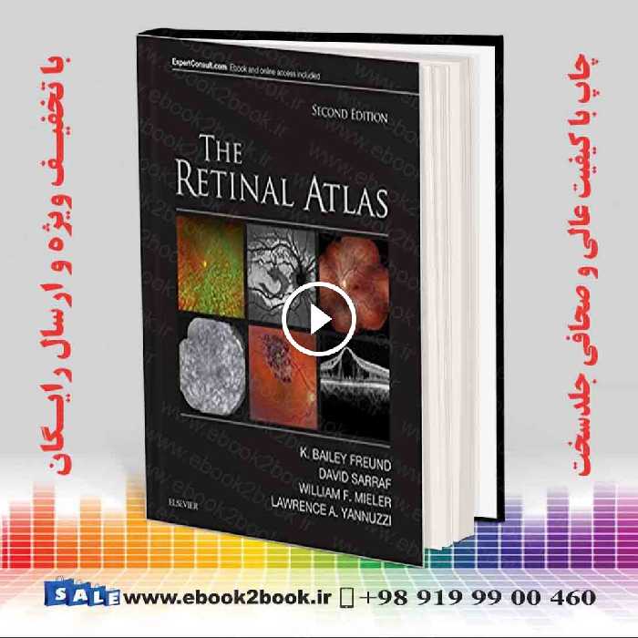 The Retinal Atlas 2nd Edition