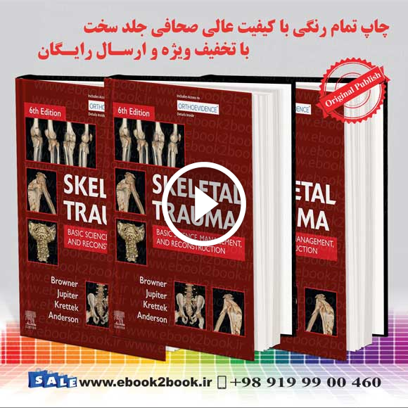 Skeletal Trauma 2-Volume Set 6th Edition