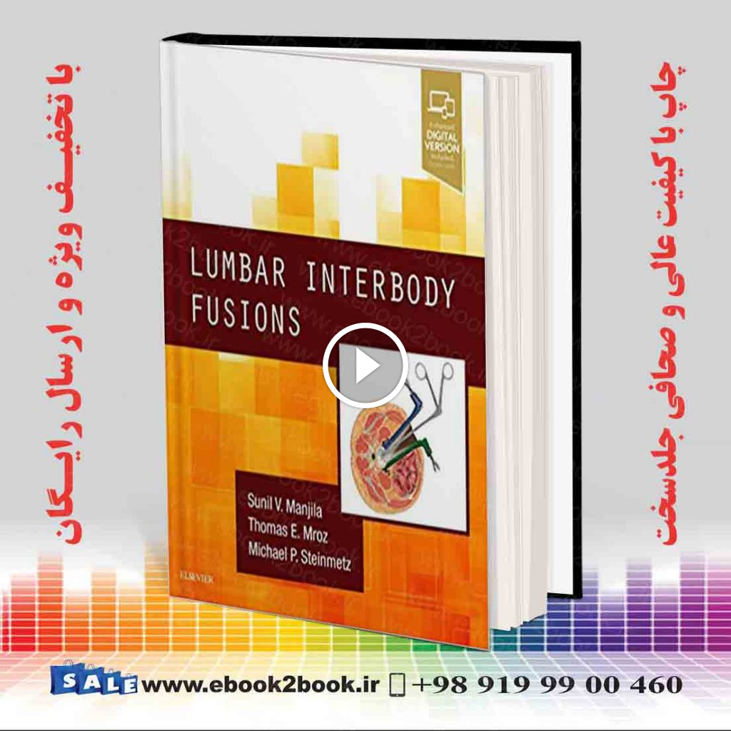 Lumbar Interbody Fusions