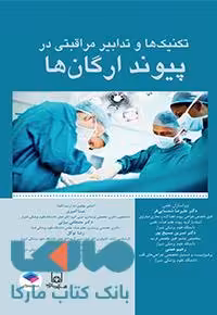 تکنیک ها و تدابیر مراقبتی در پیوند ارگان ها جامعه نگر
