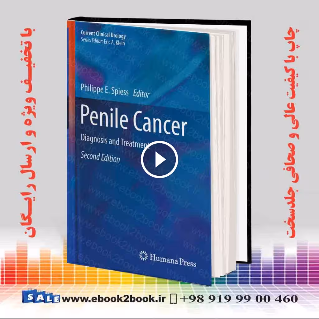 Penile Cancer: Diagnosis and Treatment 2nd Edition