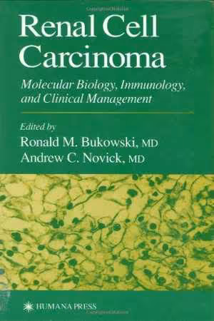 [PDF] دانلود کتاب Renal Cell Carcinoma - Molecular Biology, Immunology, And Clinical Management, 2000