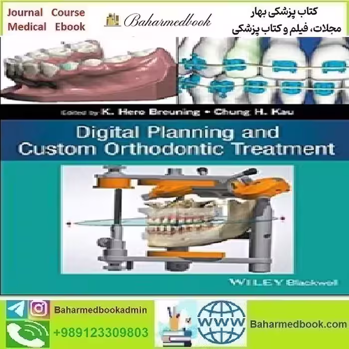 Digital Planning and Custom Orthodontic Treatment 2017