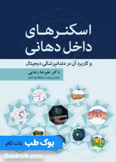 اسکنرهای داخل دهانی و کاربرد آن در دندانپزشکی دیجیتال