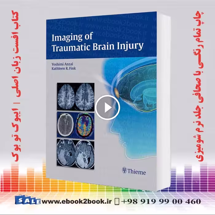 Imaging of Traumatic Brain Injury