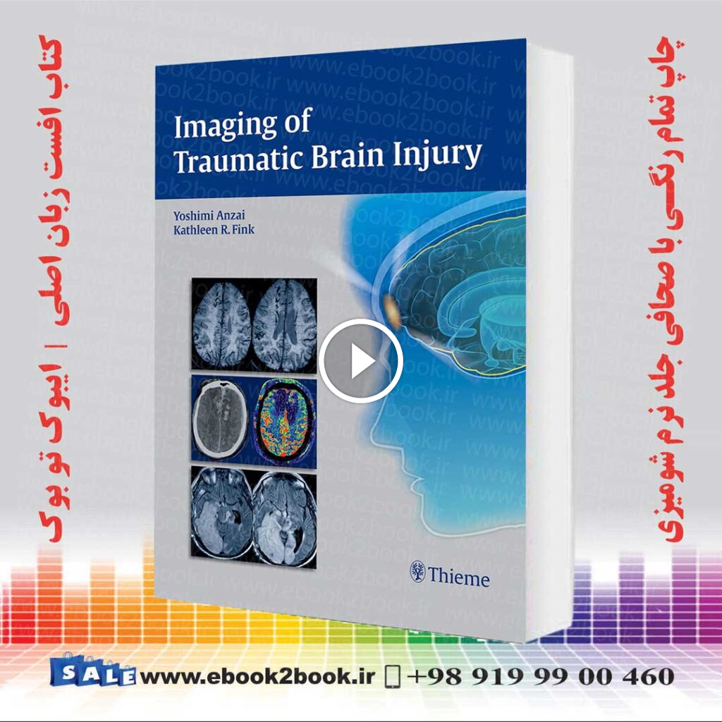 Imaging of Traumatic Brain Injury