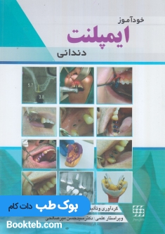 خودآموز ایمپلنت دندانی