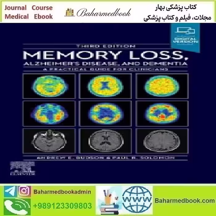 Memory Loss Alzheimer's Disease and Dementia A Practical Guide