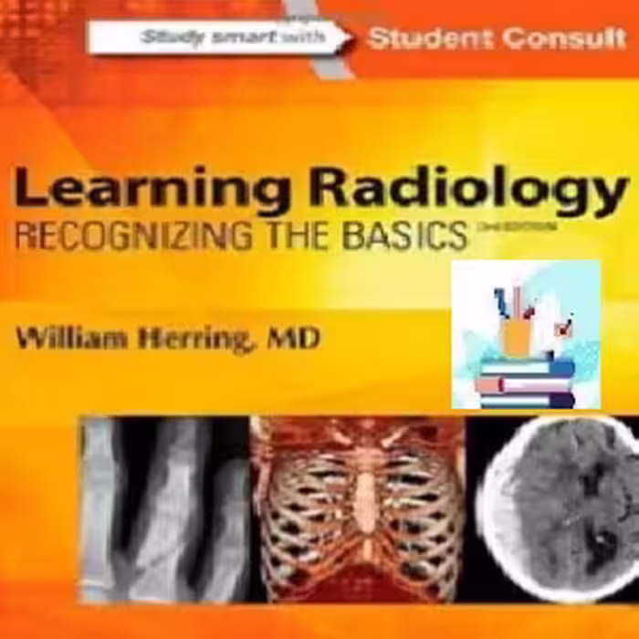 Learning Radiology TRUE PDF price 1€