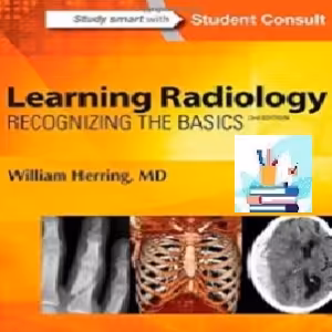 Learning Radiology TRUE PDF price 1€