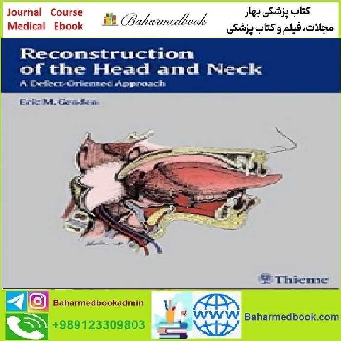 Reconstruction of the Head and Neck TRUE PDF price 1€ - کتاب پزشکی بهار