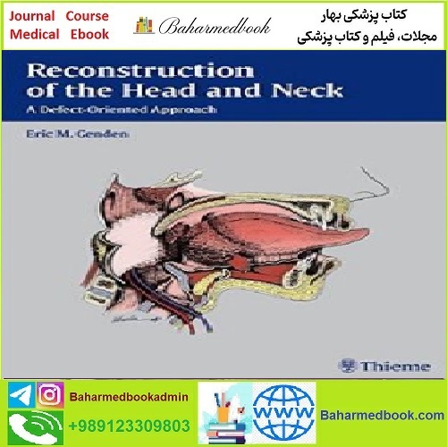Reconstruction of the Head and Neck TRUE PDF price 1€ - کتاب پزشکی بهار