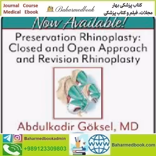Preservation Rhinoplasty Closed and Open Approach and Revisio