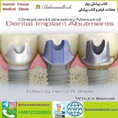 Clinical and Laboratory Manual of Dental Implant Abutments 201