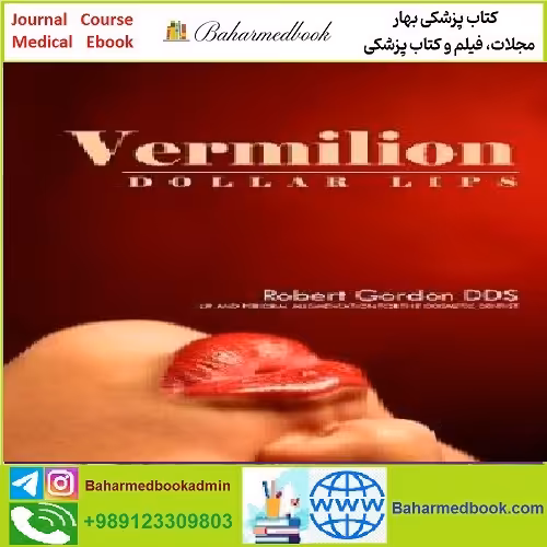 Vermilion Dollar Lips TRUE PDF price 1€