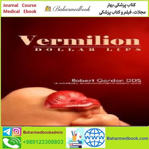 Vermilion Dollar Lips TRUE PDF price 1€