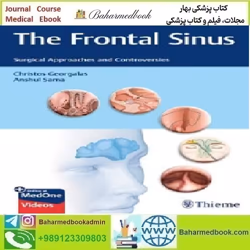 The Frontal Sinus Surgical Approaches and Controversies 2022