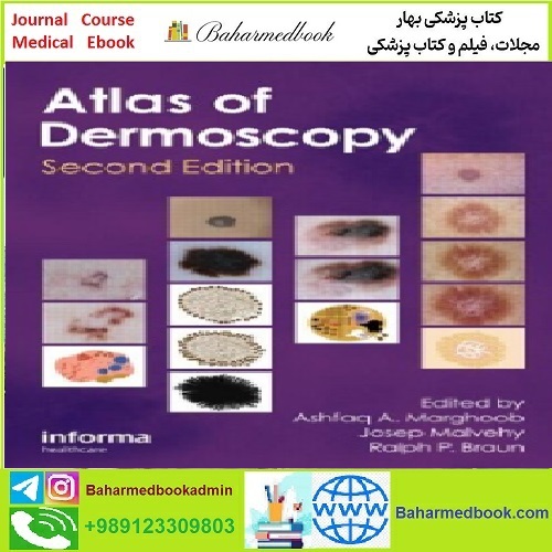 An Atlas of Dermoscopy TRUE PDF price 1€ - کتاب پزشکی بهار