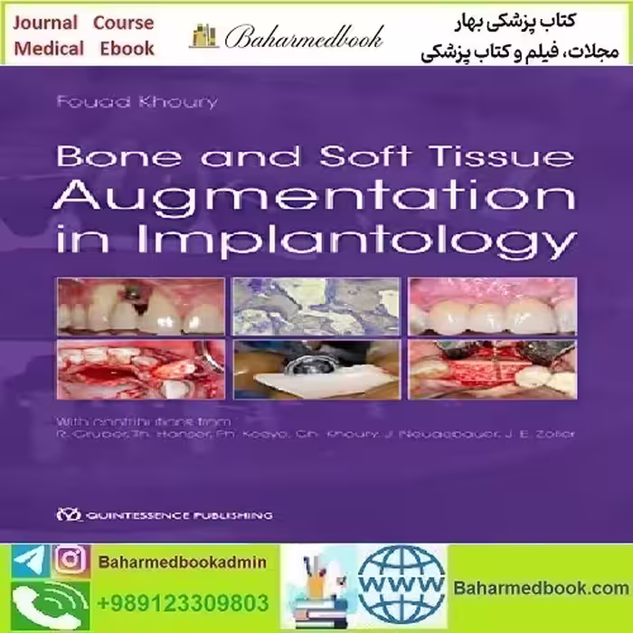 Bone and Soft Tissue Augmentation in Implantology 2021 TRUE