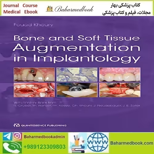 Bone and Soft Tissue Augmentation in Implantology 2021 TRUE