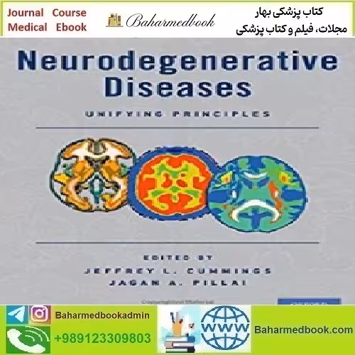 Neurodegenerative Diseases Unifying Principles 2017