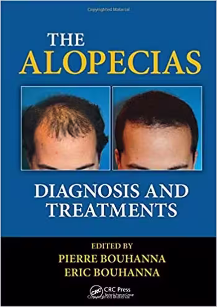The Alopecias: Diagnosis and Treatments - کتاب پزشکی بهار