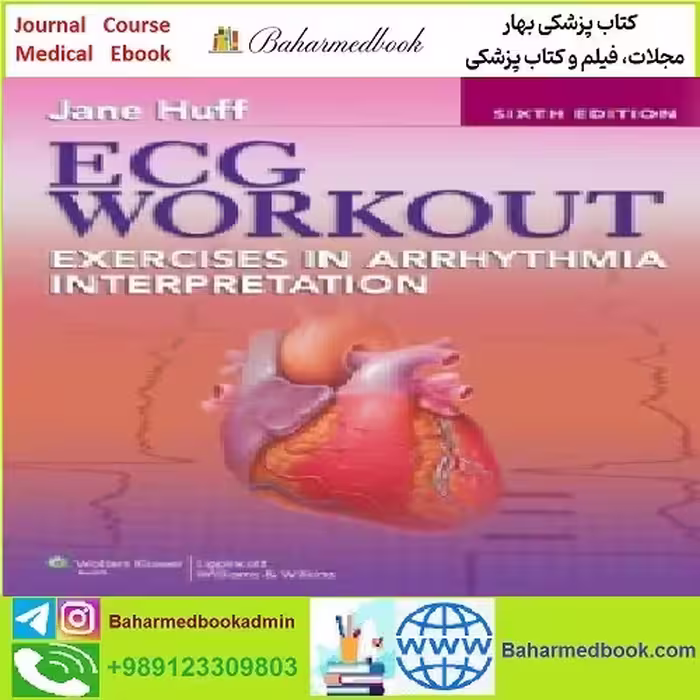 Huff's ECG Workout Exercises in Arrhythmia Interpretation TRUE