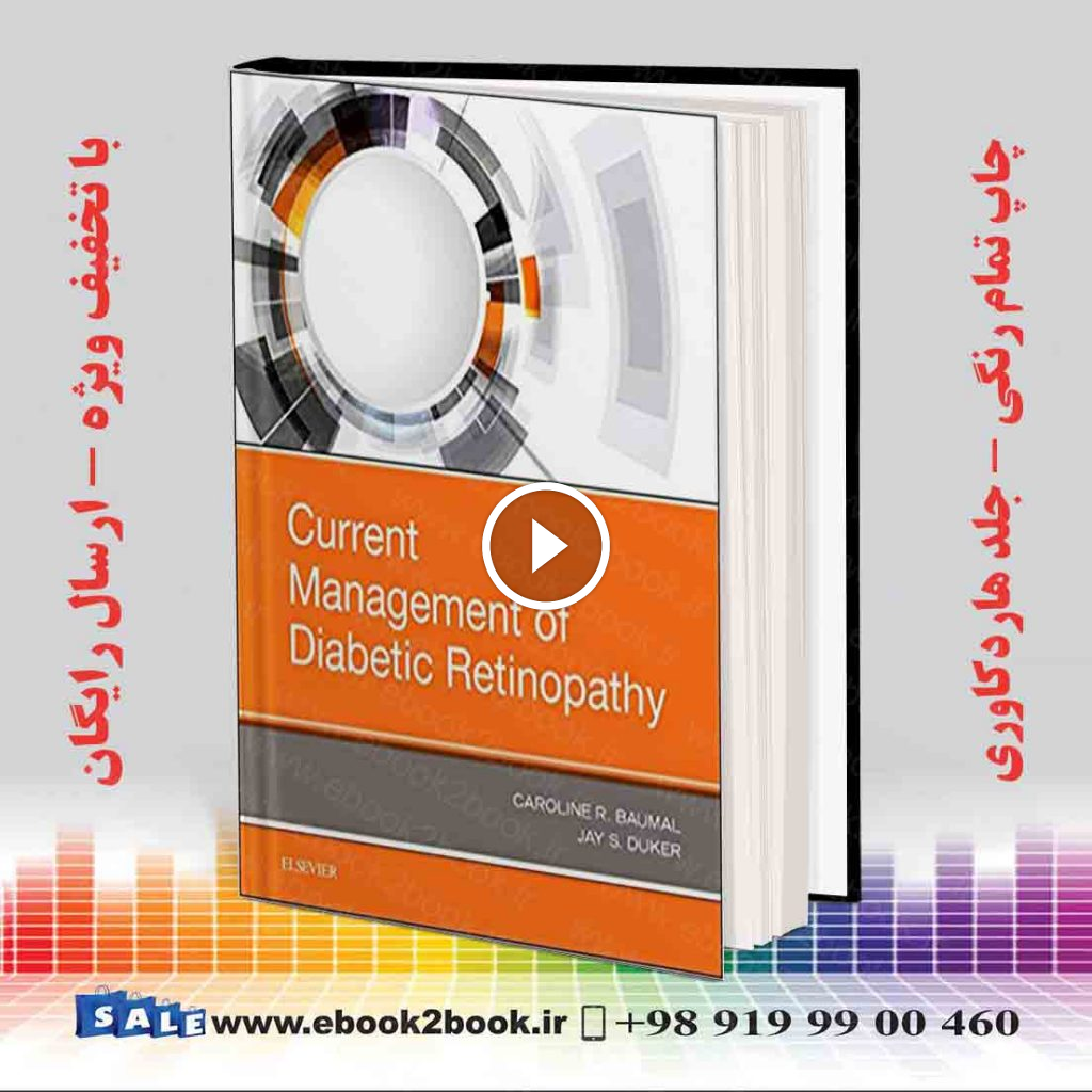 Current Management of Diabetic Retinopathy