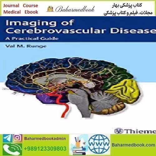 Imaging of Cerebrovascular Disease A Practical Guide 2017 TR