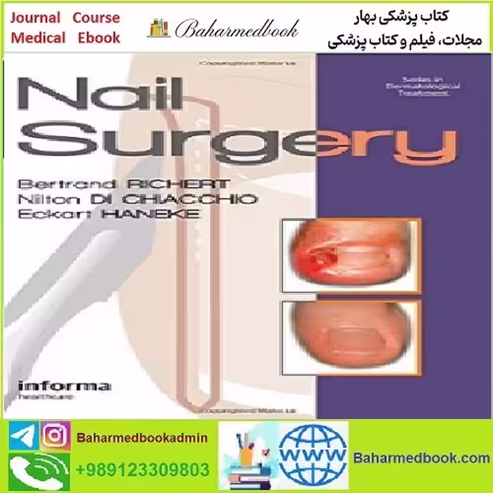 Nail Surgery TRUE PDF price 1€ - کتاب پزشکی بهار