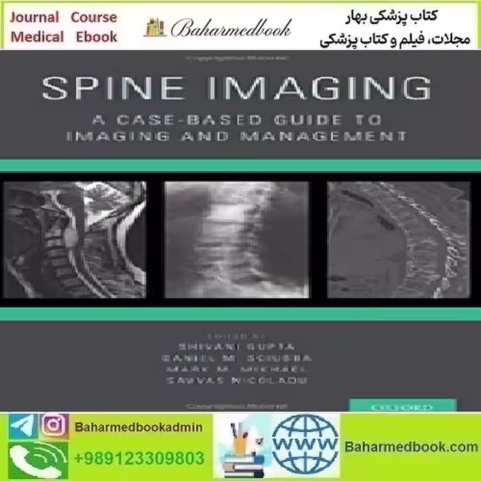 Spine Imaging A Case Based Guide to Imaging and Management