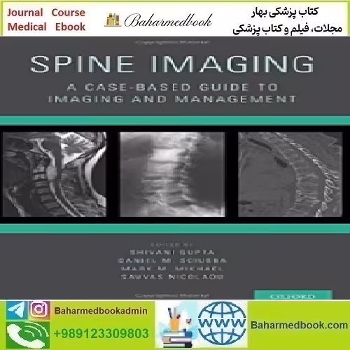 Spine Imaging A Case Based Guide to Imaging and Management