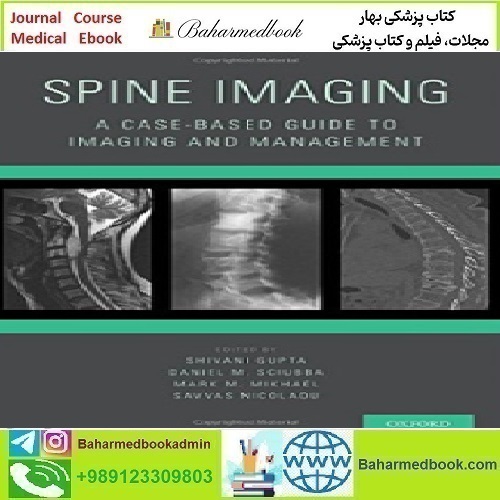 Spine Imaging A Case Based Guide to Imaging and Management