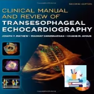 Clinical Manual and Review of Transesophageal Echocardiograph