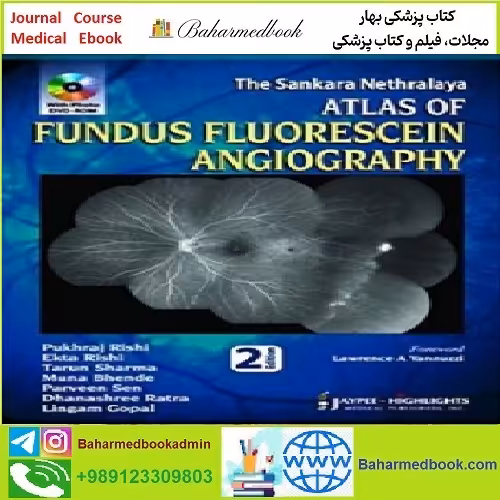 The Sankara Nethralaya Atlas of Fundus Fluorescein Angiograph