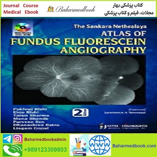 The Sankara Nethralaya Atlas of Fundus Fluorescein Angiograph