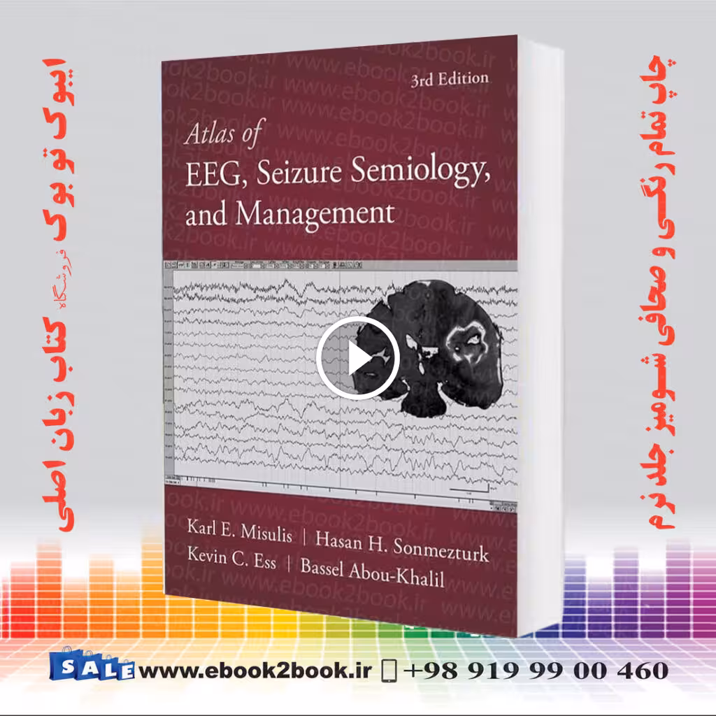 Atlas of EEG, Seizure Semiology, and Management 3rd Edition