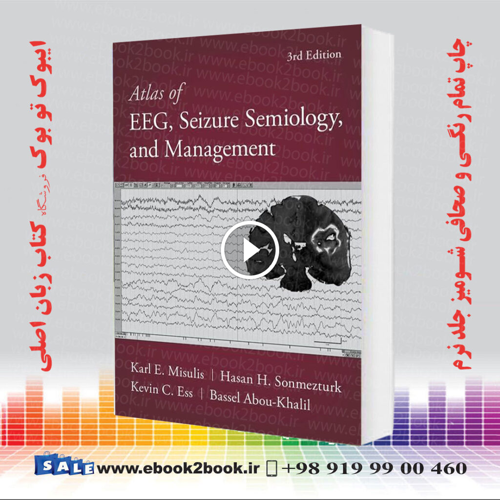 Atlas of EEG, Seizure Semiology, and Management 3rd Edition