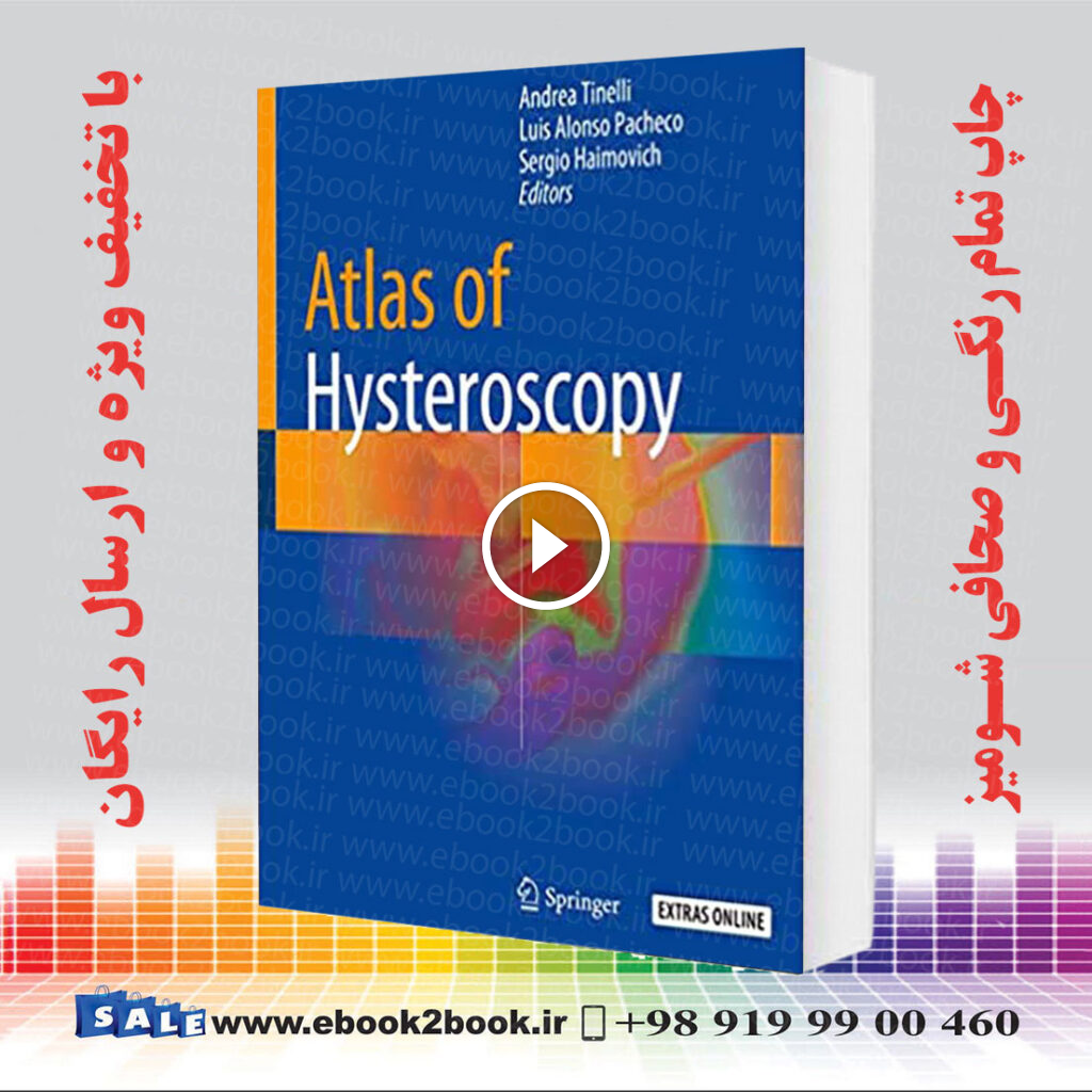 Atlas of Hysteroscopy