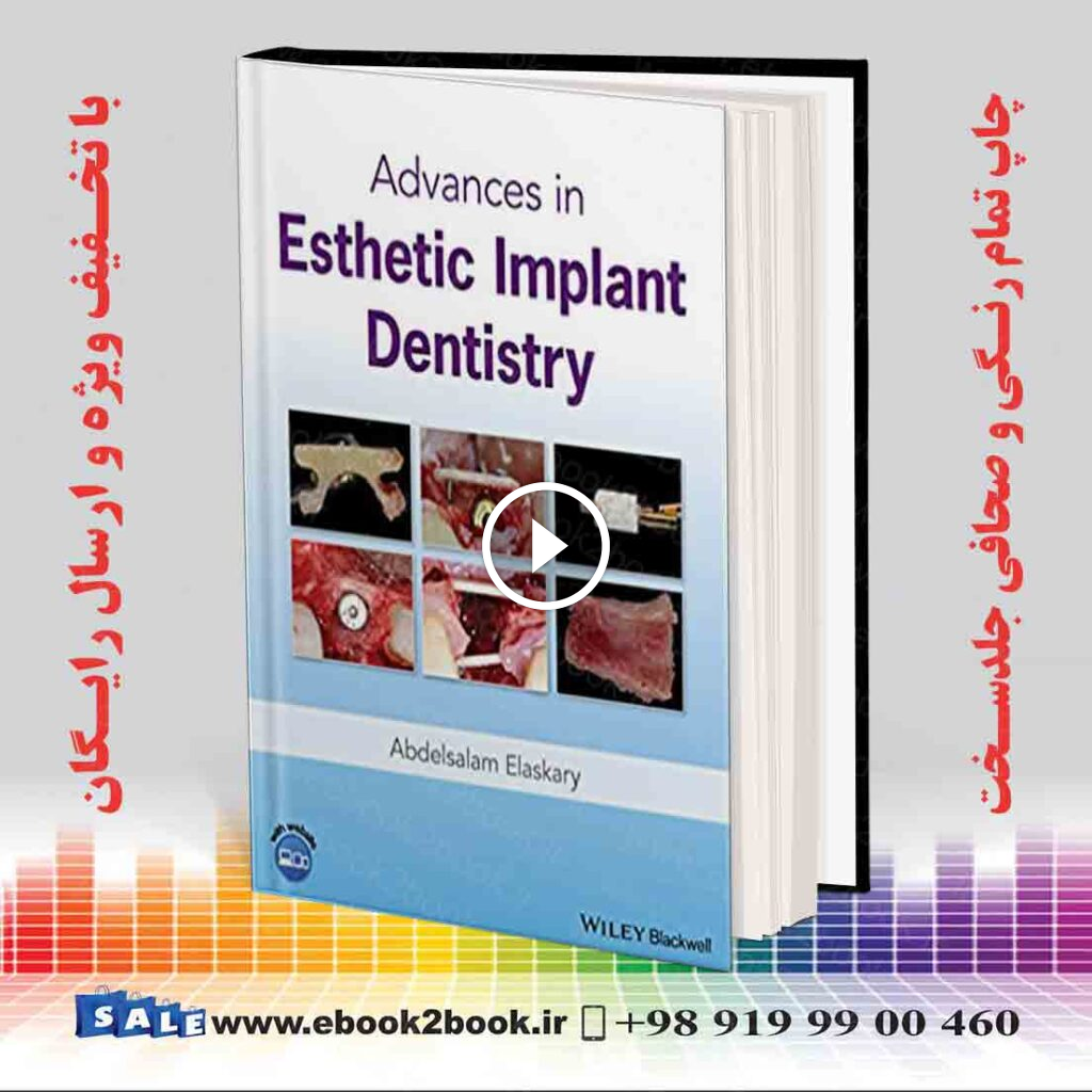 Advances in Esthetic Implant Dentistry