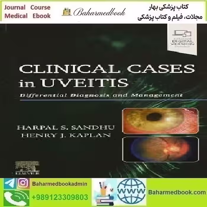 Clinical Cases in Uveitis Differential Diagnosis and Management