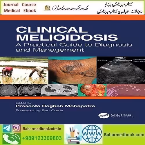 Clinical Melioidosis A Practical Guide to Diagnosis and