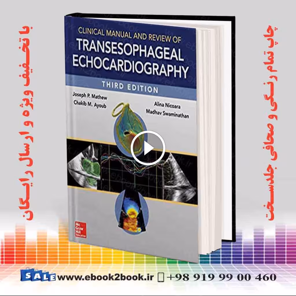 Clinical Manual and Review of Transesophageal Echocardiography 3rd Edition