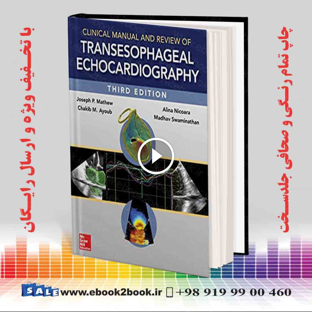 Clinical Manual and Review of Transesophageal Echocardiography 3rd Edition