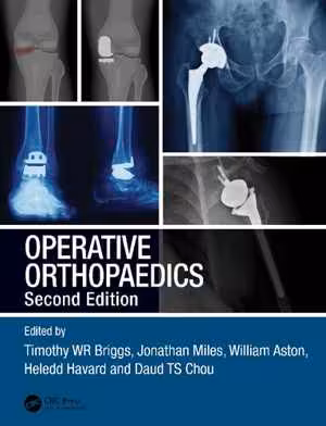[PDF] دانلود کتاب Operative Orthopaedics, 2nd ed, 2020