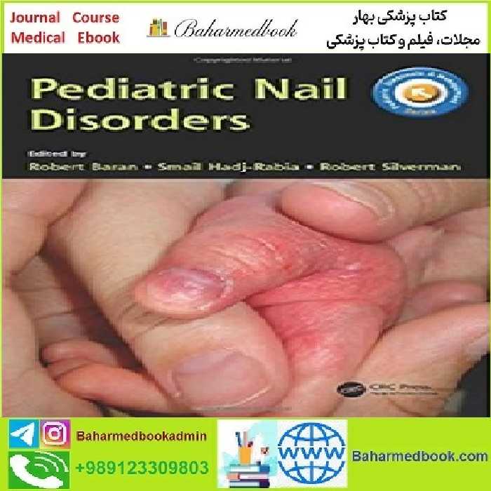 Pediatric Nail Disorders TRUE PDF price 1€ - کتاب پزشکی بهار